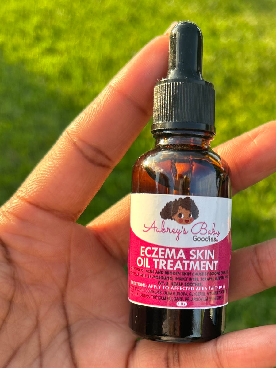 Nourishing Eczema Skin Oil for Gentle Relief Aubrey s Baby Goodies