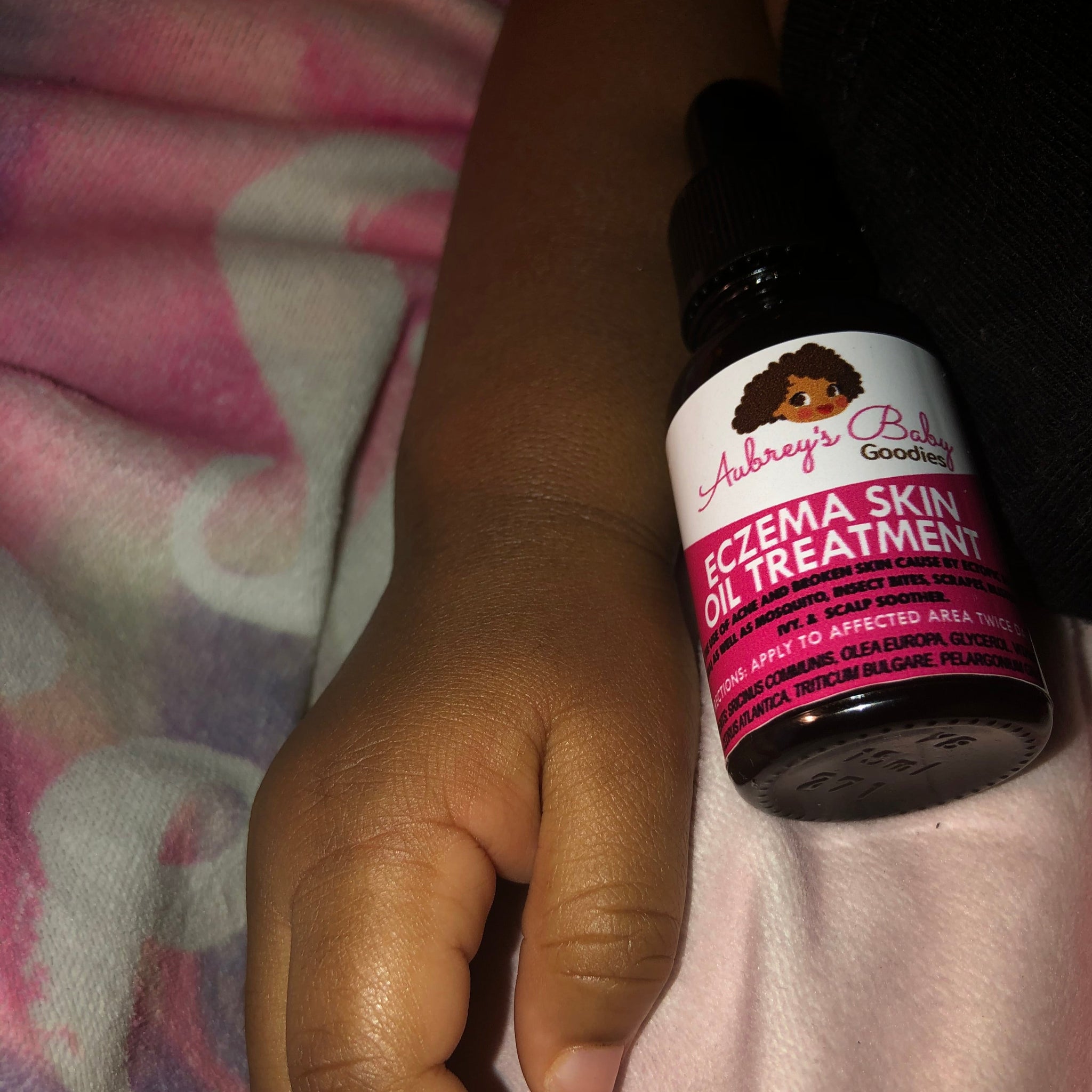 1oz Eczema Oil Bundle