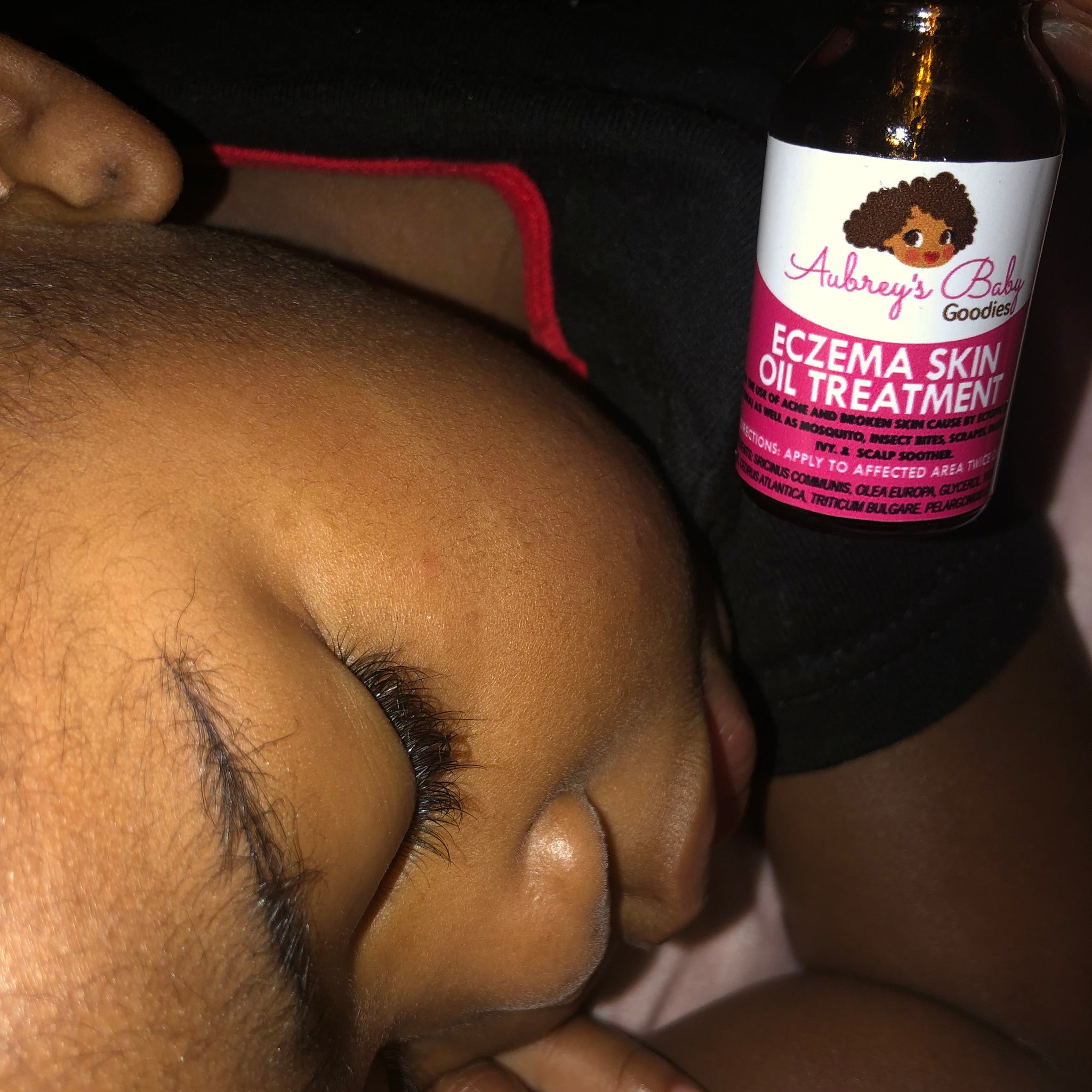 Nourishing Eczema Skin Oil for Gentle Relief