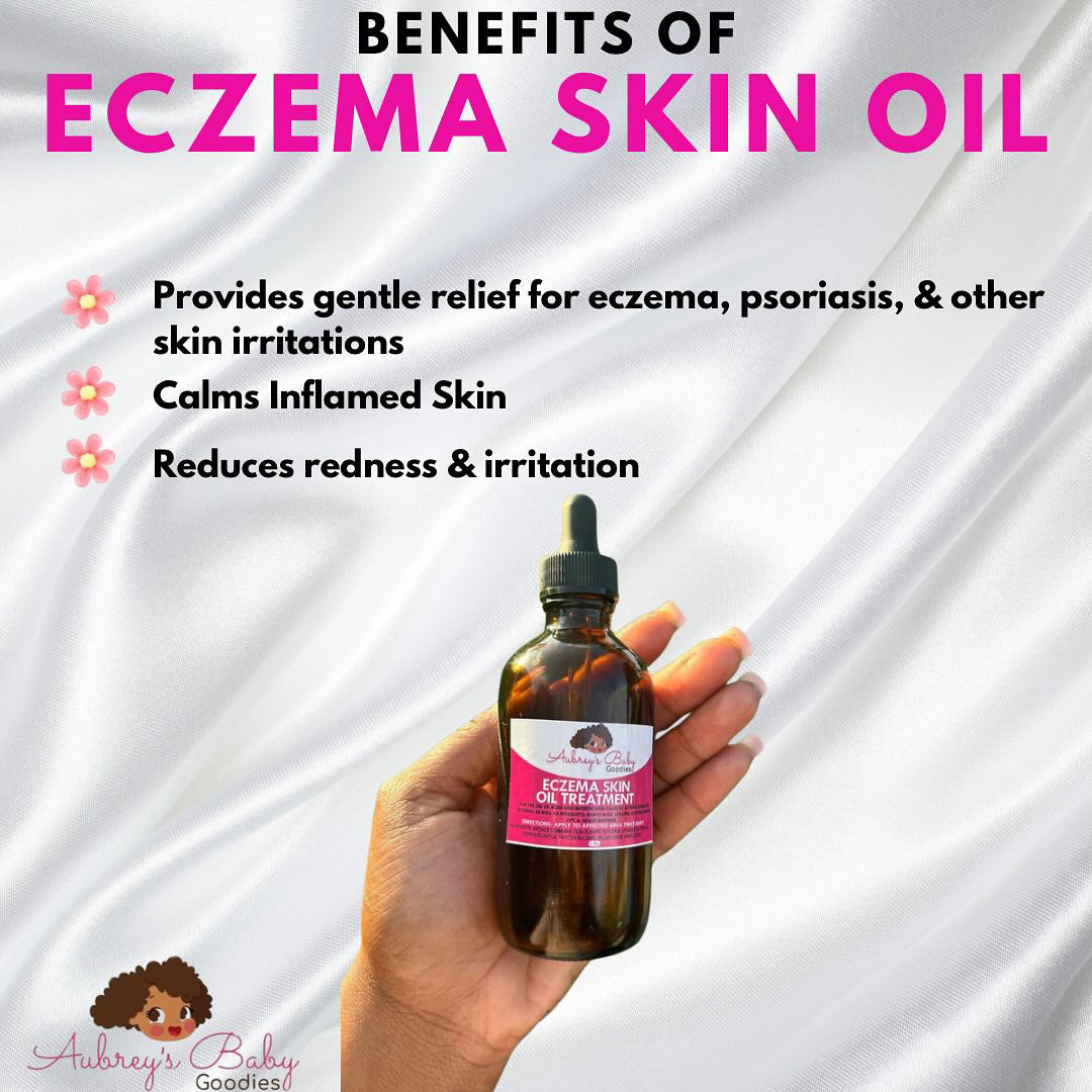 Nourishing Eczema Skin Oil for Gentle Relief